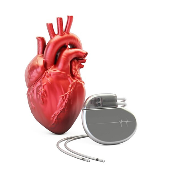 Pacemaker and Device Management